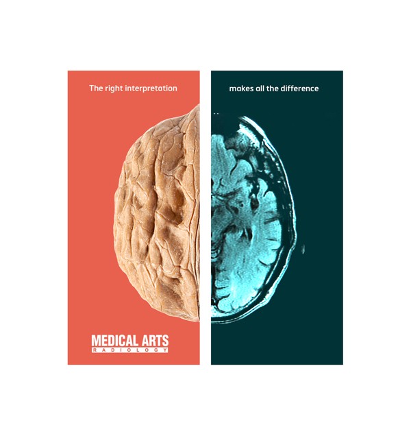 以形补形吃啥补啥-Abed Marzouk [22P].jpg