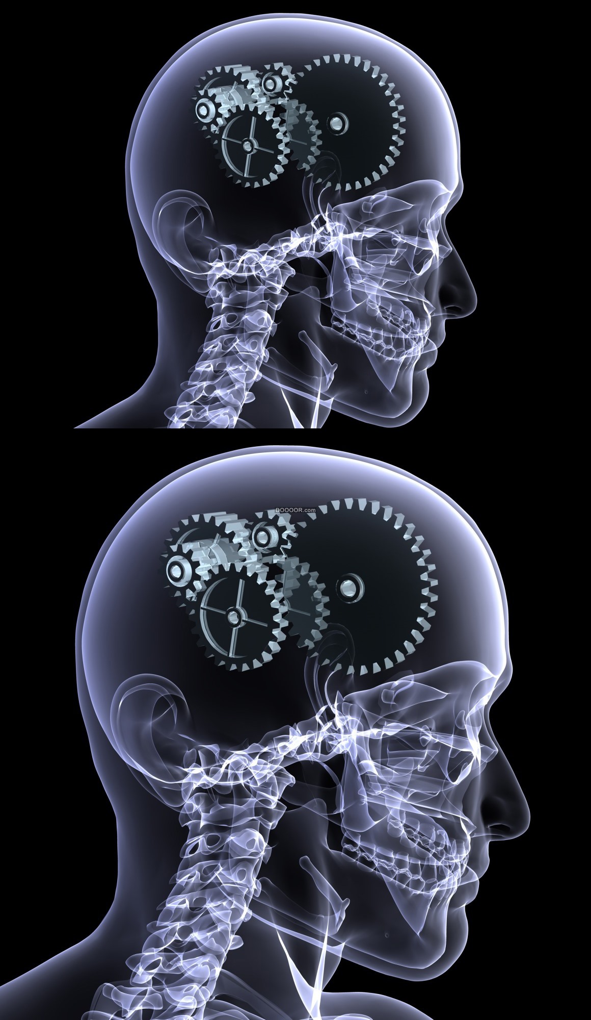 头脑机械变异体图片