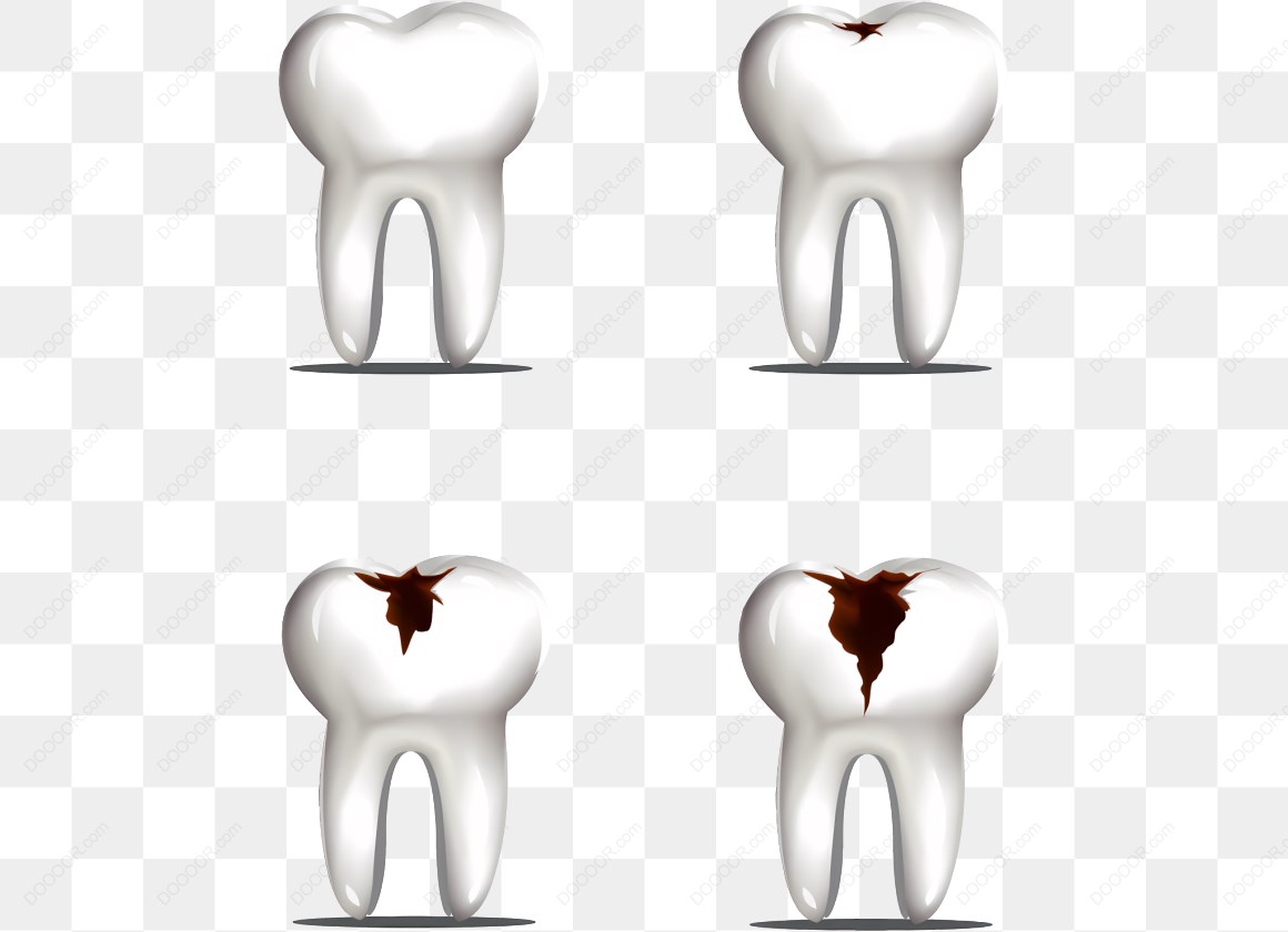 19066_蛀牙和牙齿腐烂.jpg